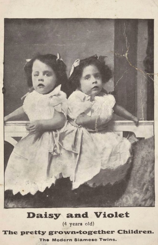 Violet and Daisy Hilton